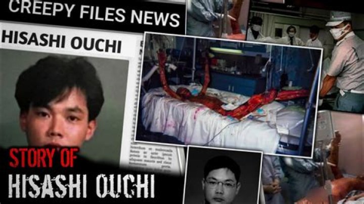 Hisashi Ouchi Real: The Tragic Story of Unthinkable Radiation Exposure
