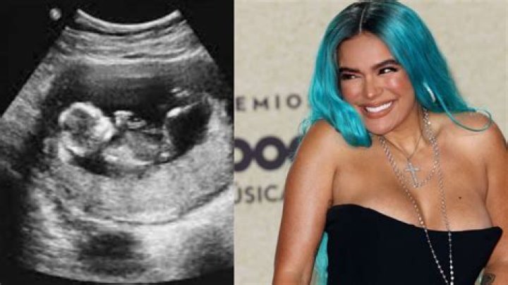 Karol G Pregnant? Unpacking the Latest Rumors and What We Know