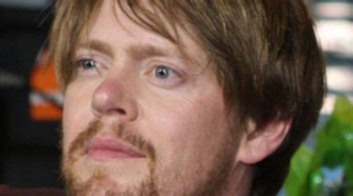 Kris Marshall Face Surgery: Unpacking the Whispers and What We Know